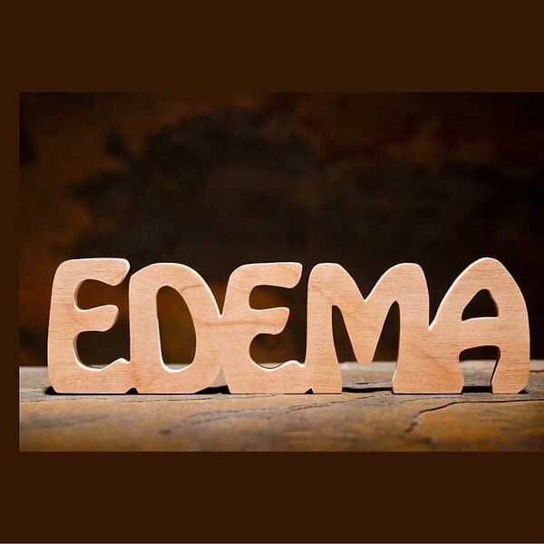 Edema