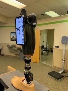 Custom Prosthetics Improve Mental Well Being 1